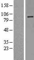 ls057628 dpp10 human over expression lysates nm 020868 wb testing 1