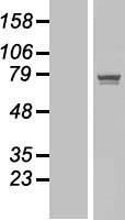 POGK Human Over-expression Lysates NM_017542