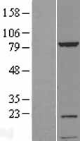 KIAA1530 (UVSSA) Human Over-expression Lysates NM_020894