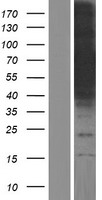 CoCoA (CALCOCO1) Human Over-expression Lysates NM_001143682