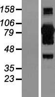 CoCoA (CALCOCO1) Human Over-expression Lysates NM_020898