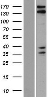 ls057662 kiaa1543 camsap3 human over expression lysates nm 001080429 wb testing 1