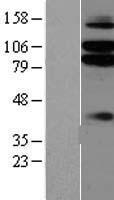ls057689 netrin g1 ligand lrrc4c human over expression lysates nm 020929 wb testing 1