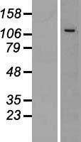 CWC22 Human Over-expression Lysates NM_020943