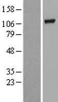 ls057704 gba2 human over expression lysates nm 020944 wb testing 1