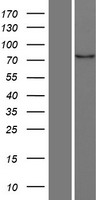 MARK4 Human Over-expression Lysates NM_031417