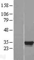 Ocular development associated gene (GATAD1) Human Over-expression Lysates NM_021167