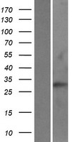RAB40C Human Over-expression Lysates NM_021168