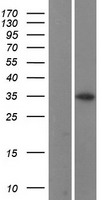 CCNB1IP1 Human Over-expression Lysates NM_021178