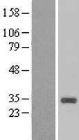 CCNB1IP1 Human Over-expression Lysates NM_182851