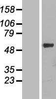 CYPIVF11 (CYP4F11) Human Over-expression Lysates NM_021187