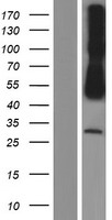 CADM3 Human Over-expression Lysates NM_021189