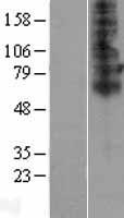 TSCOT (SLC46A2) Human Over-expression Lysates NM_033051