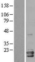 Neuroglobin (NGB) Human Over-expression Lysates NM_021257
