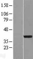 NEUROD4 Human Over-expression Lysates NM_021191