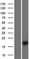 WFDC1 Human Over-expression Lysates NM_021197