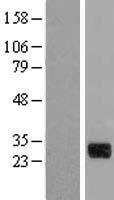 CTDSP1 Human Over-expression Lysates NM_021198