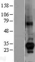 CTDSP1 Human Over-expression Lysates NM_182642