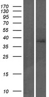 TP53INP2 Human Over-expression Lysates NM_021202
