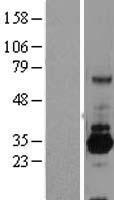 SRPR beta (SRPRB) Human Over-expression Lysates NM_021203