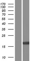 TRAPPC1 Human Over-expression Lysates NM_001166621