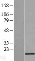 TRAPPC1 Human Over-expression Lysates NM_021210
