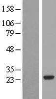 PCTP Human Over-expression Lysates NM_021213