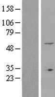 ls058492 znf77 human over expression lysates nm 021217 wb testing 1