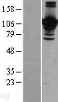 Junctional Adhesion Molecule 2 (JAM2) Human Over-expression Lysates NM_021219