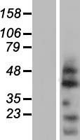 OVOL2 Human Over-expression Lysates NM_021220