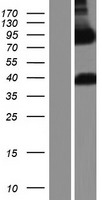 ls058504 arhgap22 human over expression lysates nm 021226 wb testing 1