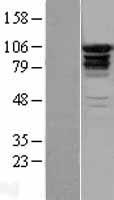 EPS15R (EPS15L1) Human Over-expression Lysates NM_021235