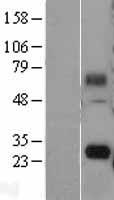 SINHCAF Human Over-expression Lysates NM_021238