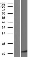 C6orf115 (ABRACL) Human Over-expression Lysates NM_021243