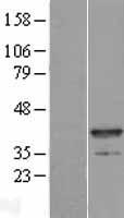 Myozenin 1 (MYOZ1) Human Over-expression Lysates NM_021245