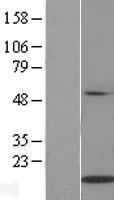 IL21 Human Over-expression Lysates NM_021803