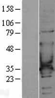 CACNG6 Human Over-expression Lysates NM_145814