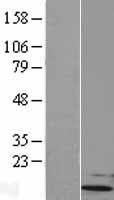 UBL5 Human Over-expression Lysates NM_024292