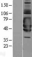 SIGIRR Human Over-expression Lysates NM_001135054