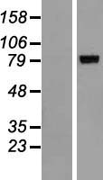ALOXE3 Human Over-expression Lysates NM_021628