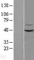 C3IP1 (KLHL12) Human Over-expression Lysates NM_021633