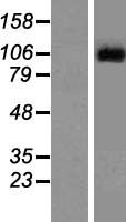 LGR6 Human Over-expression Lysates NM_001017403