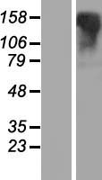 LGR6 Human Over-expression Lysates NM_021636