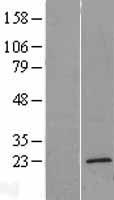 TMEM35 (TMEM35A) Human Over-expression Lysates NM_021637
