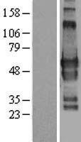 GPBP1L1 Human Over-expression Lysates NM_021639