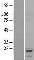 ls060370 avpi1 human over expression lysates nm 021732 wb testing 1