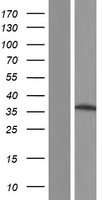 SLC25A19 Human Over-expression Lysates NM_021734
