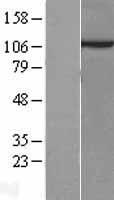 Sec8 (EXOC4) Human Over-expression Lysates NM_021807