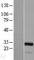 TGF beta induced factor 2 (TGIF2) Human Over-expression Lysates NM_021809