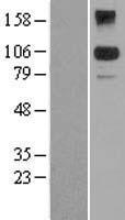 BACH2 Human Over-expression Lysates NM_021813